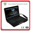 SY-A007 Small Notebook Ultrasound Mini Ultrasound Machine